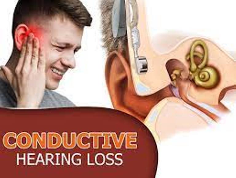 Major Causes of Conductive Hearing Loss